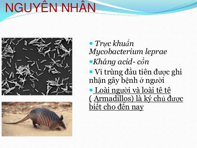 Mycobacterium leprae (M. leprae) là vi khuẩn gây bệnh phong ở người